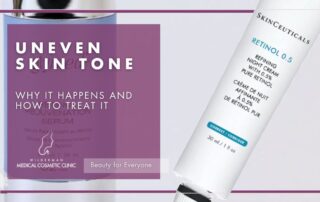 Retinoids: Small Step, Big Difference for Skin