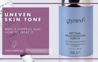 Retinoids: Small Step, Big Difference for Skin
