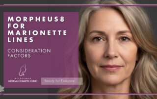 Morpheus8 for Marionette Lines - Consideration Factors