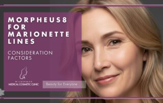 Morpheus8 for Marionette Lines - Consideration Factors