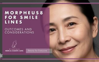 Morpheus8 for Smile Lines - Wilderman Medical Clinic