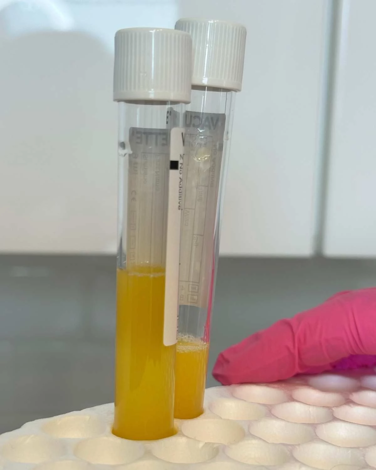 PRF gel