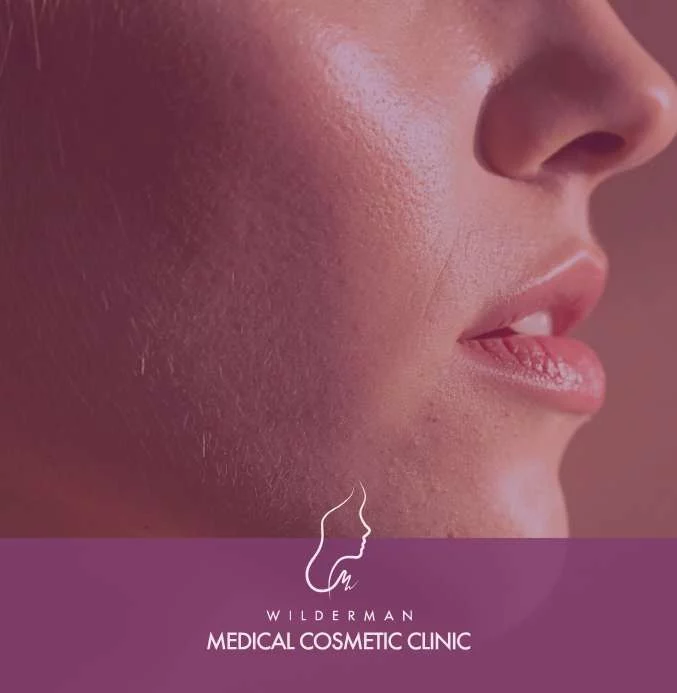 Benefits, Treatment, Takeaway Botox®