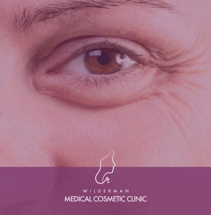 A Guide to Youthful Eyes