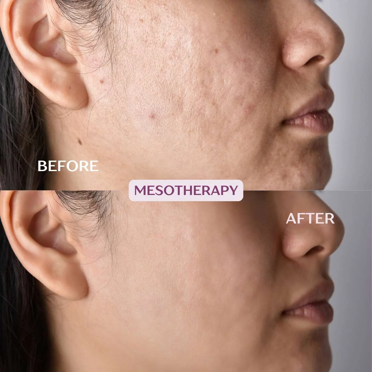 Price List for Medical Cosmetic Treatments