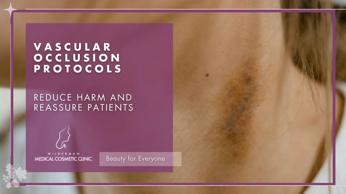 Vascular Occlusion Protocols. reduce harm and reassure patients