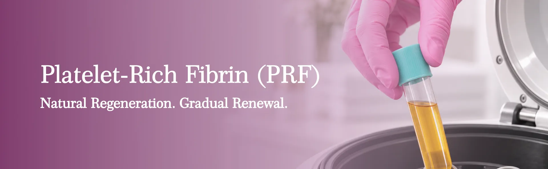 Platelet-Rich Fibrin (PRF)